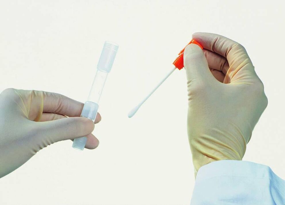 Analīzes kolekcija, lai noteiktu hronisku prostatītu