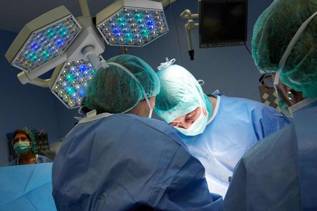 Operācija hroniskā prostatīta gadījumā