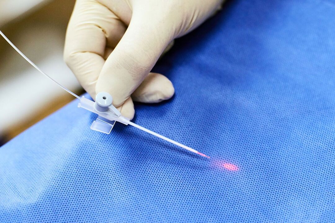 transrektāla ierīce prostatas ārstēšanai